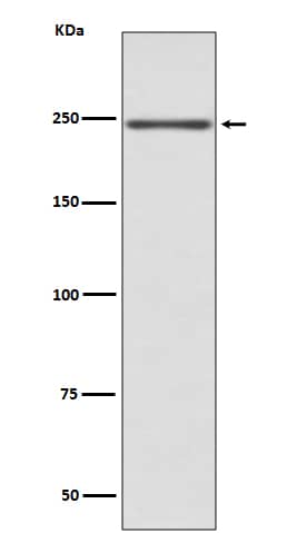 Western Blot: MYH6/7 Antibody (SR1338) [NBP3-21708] - Western blot analysis using NBP3-21708 in mouse heart lysate.