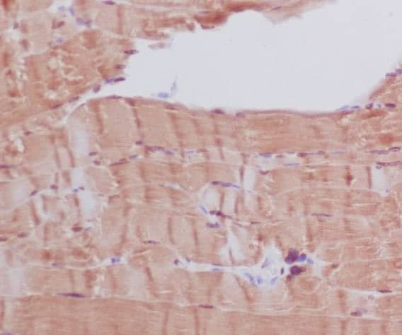 Immunohistochemistry: MYH6/7 Antibody (SR1338) [NBP3-21708] - Immunohistochemical analysis of paraffin-embedded human skeletal muscle, using NBP3-21708.