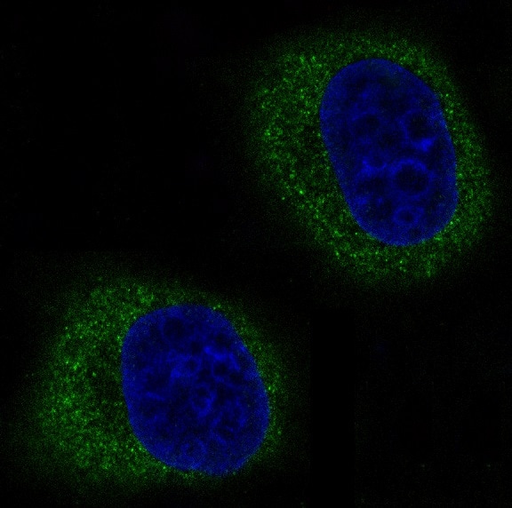 Immunocytochemistry/Immunofluorescence: Mitofusin 2 Antibody (SR2236) [NBP3-21710] - Immunofluorescent analysis of Hela cells, using NBP3-21710.