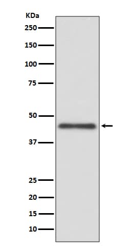 Western Blot: HLA G Antibody (SR1708) [NBP3-21711] - Western blot analysis using NBP3-21711 in Jurkat cell lysate.