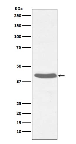 Western Blot: MHC Class I Antibody (SR1692) [NBP3-21713] - Western blot analysis using NBP3-21713 in Raji cell lysate.