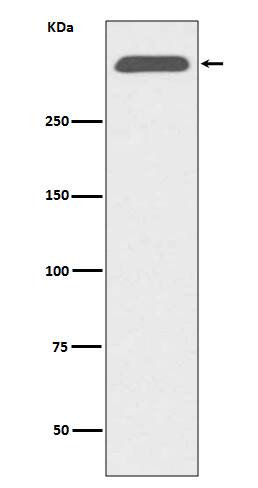 Western Blot: Apolipoprotein B/ApoB Antibody (SR1898) [NBP3-21714] - Western blot analysis using NBP3-21714 in human serum lysate.