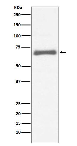 Western Blot: alpha-Fetoprotein/AFP Antibody (SR2120) [NBP3-21716] - Western blot analysis using NBP3-21716 in HepG2 cell lysate.