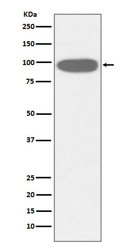 Western Blot: gp96/HSP90B1/GRP94 Antibody (SR2295) [NBP3-21723] - Western blot analysis using NBP3-21723 in HeLa cell lysate.