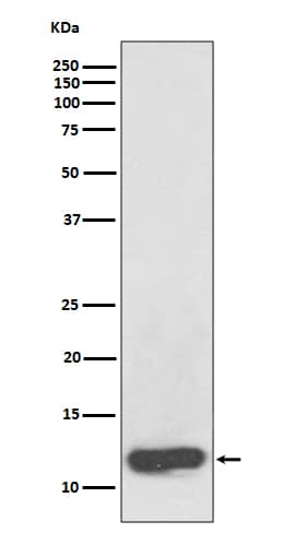 Western Blot: Serum Amyloid A1/A2 Antibody (SR1117) [NBP3-21727] - Western blot analysis using NBP3-21727 in human plasma lysate.