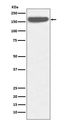 Western Blot: SOS1 Antibody (SR1203) [NBP3-21731] - Western blot analysis using NBP3-21731 in HeLa cell lysate.