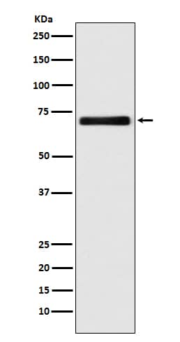 Western Blot: EAAT2/GLT1 Antibody (SR2082) [NBP3-21735] - Western blot analysis using NBP3-21735 in HeLa cell lysate.