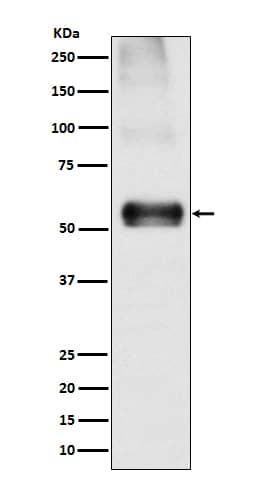 Western Blot: EAAT1/GLAST-1/SLC1A3 Antibody (SR2039) [NBP3-21738] - Western blot analysis using NBP3-21738 in Mouse brain lysate.