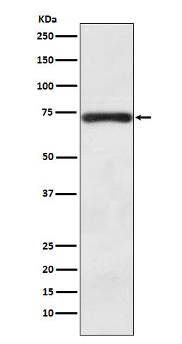 Western Blot: BACE-1 Antibody (SR2142) [NBP3-21741] - Western blot analysis using NBP3-21741 in SH-SY5Y cell lysate.