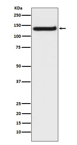 Western Blot: TLR9 Antibody (SR1133) [NBP3-21742] - Western blot analysis using NBP3-21742 in Raji cell lysate.