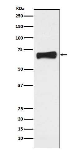 Western Blot: LRH-1/NR5A2 Antibody (SR2100) [NBP3-21744] - Western blot analysis using NBP3-21744 in MCF7 cell lysate.