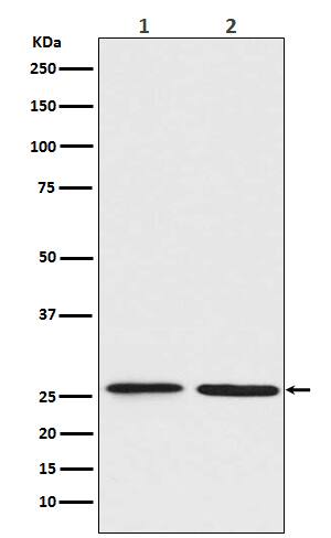 Western Blot: BNIP1 Antibody (SR1417) [NBP3-21748] - Western blot analysis using NBP3-21748 in (1) Jurkat cell lysate; (2) C6 cell lysate.