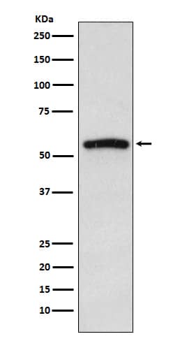 Western Blot: IRAK4 Antibody (SR1922) [NBP3-21753] - Western blot analysis using NBP3-21753 in Jurkat cell lysate.