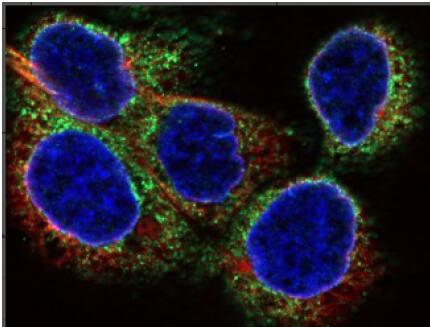 Immunocytochemistry: PTGER2 Antibody (SR1927) [NBP3-21756] - analysis of JAR cells labeling PTGER2with PTGER2 Rabbit mAb (56192) at 1/100 dilution. Cellswere fixed in 4% paraformaldehyde for 10 minutes at 37 °C,permeabilized with 0.05% Triton X-100 in PBS for 20 minutes,and then blocked with 2% negative goat serum for 30 minutesat room temperature. Cells were then incubated with PTGER2Rabbit mAb (56192) at 1/100 dilution in 2% negative goatserum overnight at 4 °C. Goat Anti-Rabbit IgG H&L was usedas the secondary antibody at 1/1,000 dilution. Nuclear DNAwas labelled in blue with DAPI. Beta tubulin (red) was stainedat 1/200 dilution overnight at +4°C. Goat Anti-Mouse IgG H&Lwas used as the secondary antibody at 1/1,000 dilution.