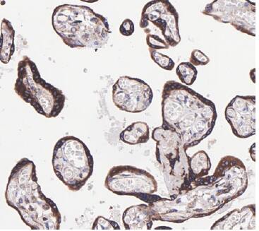 Western Blot: PTGER2 Antibody (SR1927) - BSA Free [NBP3-21756] - Immunohistochemical analysis of paraffin-embedded humanplacenta tissue with PTGER2 Rabbit mAb  at 1/1,000dilution.