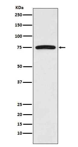 Western Blot: FRS2 Antibody (SR2015) [NBP3-21759] - Western blot analysis using NBP3-21759 in HeLa cell lysate.