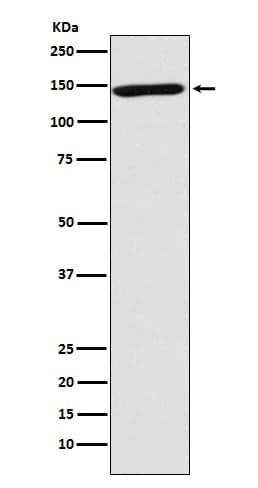 Western Blot: NrCAM Antibody (SR1164) [NBP3-21760] - Western blot analysis using NBP3-21760 in human forebrain lysate.