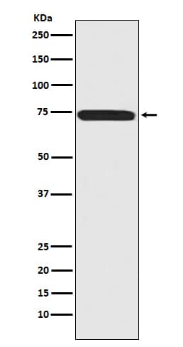 Western Blot: Menin Antibody (SR2123) [NBP3-21766] - Western blot analysis using NBP3-21766 in 293T cell lysate.