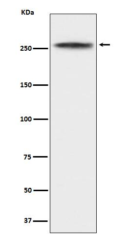 Western Blot: CHD3 Antibody (SR1409) [NBP3-21768] - Western blot analysis using NBP3-21768 in K562 cell lysate.