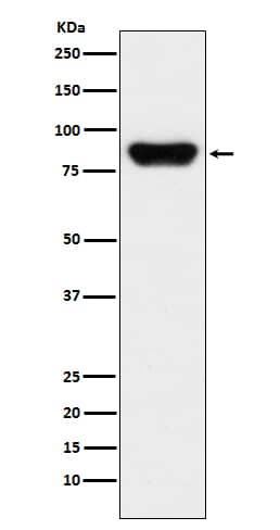 Western Blot: Prothrombin Antibody (SR2163) [NBP3-21771] - Western blot analysis using NBP3-21771 in human serum lysate.