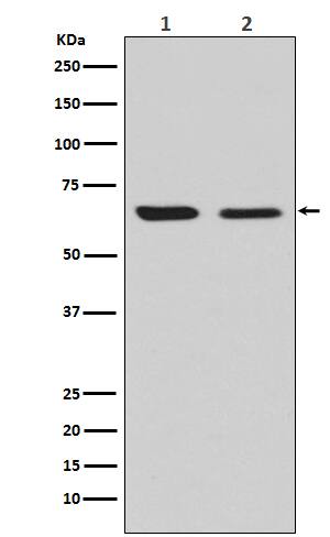 Western Blot: CRMP2 Antibody (SR2080) [NBP3-21788] - Western blot analysis using NBP3-21788 in (1) U87-MG cell lysate; (2) NIH/3T3 cell lysate.