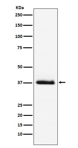 Western Blot: PTH Antibody (SR1601) [NBP3-21792] - Western blot analysis using NBP3-21792 in human PTH recombinant protein.
