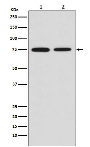 Western Blot: SR-AI/MSR Antibody (SR2199) [NBP3-21796] - Western blot analysis using NBP3-21796 in (1) HeLa cell lysate; (2) Mouse placenta lysate.