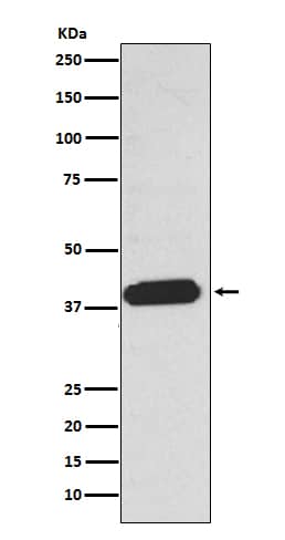 Western Blot: LPAR1/LPA1/EDG-2 Antibody (SR1651) [NBP3-21799] - Western blot analysis using NBP3-21799 in A375 cell lysate.