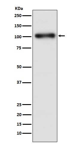 Western Blot: GABA-B R1 Antibody (SR1045) [NBP3-21802] - Western blot analysis using NBP3-21802 in HeLa cell lysate.