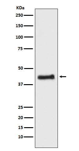 Western Blot: COUP-TF I/NR2F1 Antibody (SR1792) [NBP3-21807] - Western blot analysis using NBP3-21807 in HEK293 cell lysate.