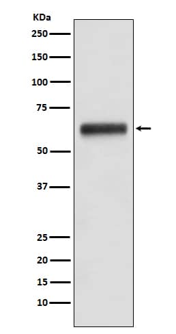 Western Blot: IgG3 Antibody (SR1690) [NBP3-21815] - Western blot analysis using NBP3-21815 in human plasma lysate.