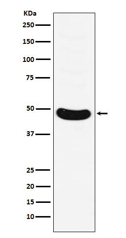 Western Blot: MNX1/HLXB9 Antibody (SR1689) [NBP3-21816] - Western blot analysis using NBP3-21816 in Molt-4 cell lysate.