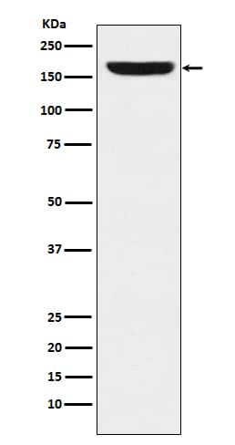 Western Blot: NRSF Antibody (SR1230) [NBP3-21822] - Western blot analysis using NBP3-21822 in HeLa cell lysate.