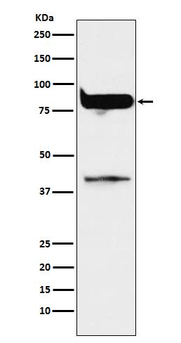 Western Blot: PKC eta Antibody (SR1663) [NBP3-21825] - Western blot analysis using NBP3-21825 in MCF7 cell lysate.