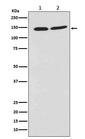 Western Blot: PHF8 Antibody (SR1157) [NBP3-21826] - Western blot analysis using NBP3-21826 in (1) Jurkat cell lysate; (2) NIH/3T3 cell lysate.