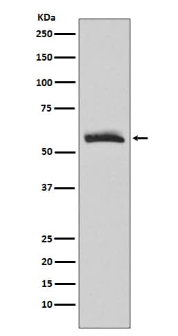 Western Blot: Muscarinic Acetylcholine Receptor M3/CHRM3 Antibody (SR2111) [NBP3-21828] - Western blot analysis using NBP3-21828 in human fetal brain lysate.