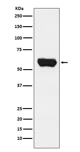 Western Blot: Lck Antibody (SR2027) [NBP3-21829] - Western blot analysis using NBP3-21829 in Jurkat cell lysate.