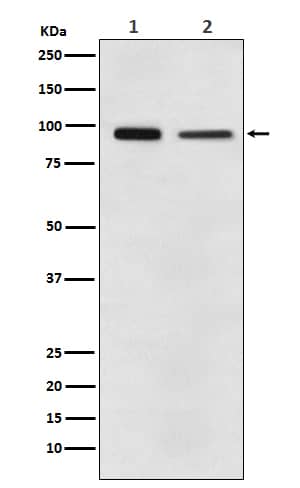 Western Blot: eEF-2 Antibody (SR2299) [NBP3-21831] - Western blot analysis using NBP3-21831 in (1) A431 cell lysate; (2) NIH/3T3 cell lysate.