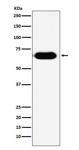 Western Blot: RNF8 Antibody (SR2063) [NBP3-21837] - Western blot analysis using NBP3-21837 in human fetal kidney lysate.