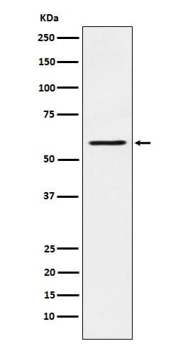 Western Blot: PAK1 Antibody (SR2113) [NBP3-21849] - Western blot analysis using NBP3-21849 in A431 cell lysate.