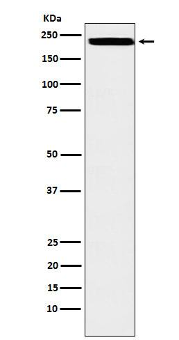Western Blot: ZEB1 Antibody (SR1312) [NBP3-21854] - Western blot analysis using NBP3-21854 in HEK293 cell lysate.