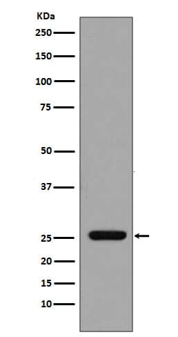 Western Blot: GST Epitope Tag Antibody (SR1415) [NBP3-21866] - Western blot analysis using NBP3-21866 in GST Epitope Tag recombinant protein.