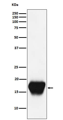 Western Blot: CD52 Antibody (SR2268) [NBP3-21870] - Western blot analysis using NBP3-21870 in Mouse spleen cell lysate.