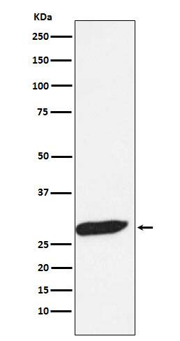 Western Blot: FHL1 Antibody (SR1507) [NBP3-21873] - Western blot analysis using NBP3-21873 in Human fetal muscle lysate.