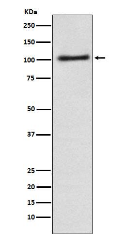 Western Blot: alpha Adaptin Antibody (SR1044) [NBP3-21875] - Western blot analysis using NBP3-21875 in A431 cell lysate.