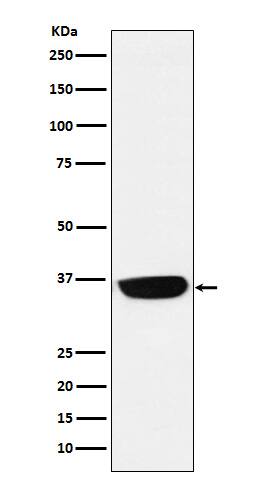 Western Blot: PHOX2B Antibody (SR1589) [NBP3-21890] - Western blot analysis using NBP3-21890 in Neuro-2a cell lysate.