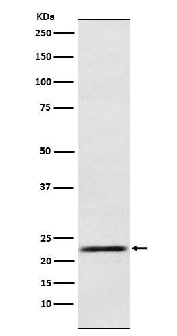 Western Blot: Prolactin Antibody (SR1366) [NBP3-21891] - Western blot analysis using NBP3-21891 in Human fetal pituitary lysate.