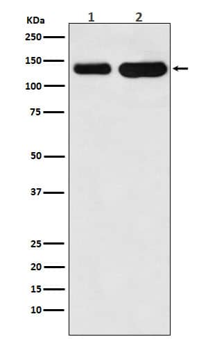 Western Blot: Cadherin-6/KCAD Antibody (SR1127) [NBP3-21896] - Western blot analysis using NBP3-21896 in (1) Jurkat cell lysate; (2) Mouse heart lysate.