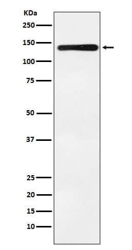 Western Blot: Bub1 Antibody (SR1102) [NBP3-21906] - Western blot analysis using NBP3-21906 in K562 cell lysate.