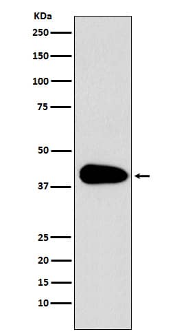 Western Blot: PARD6A Antibody (SR1623) [NBP3-21910] - Western blot analysis using NBP3-21910 in Jurkat cell lysate.